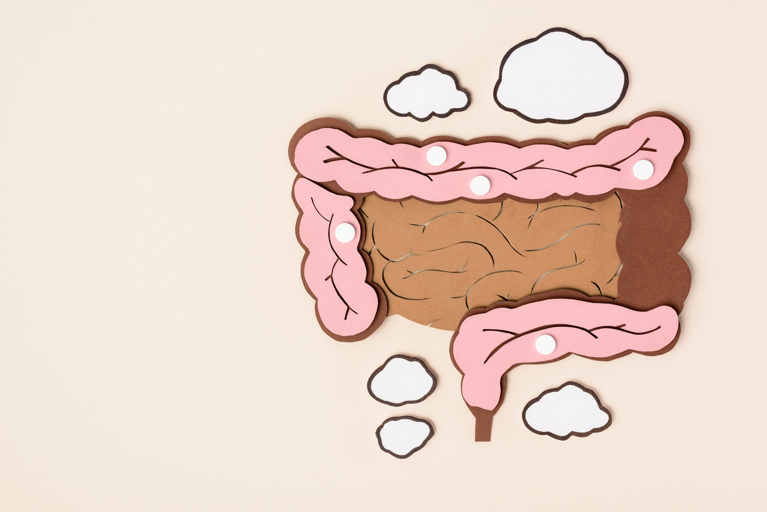 microbiota-analysis-stage